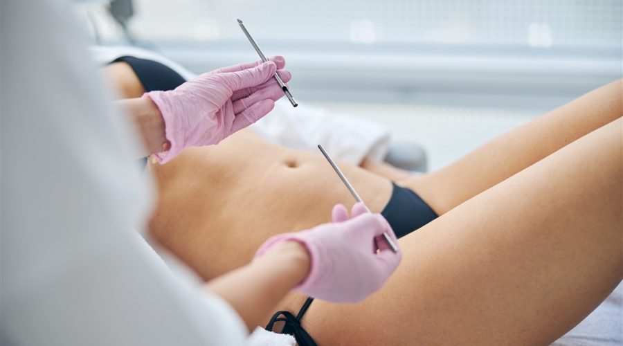 avancées technique de biopsie de la vulve